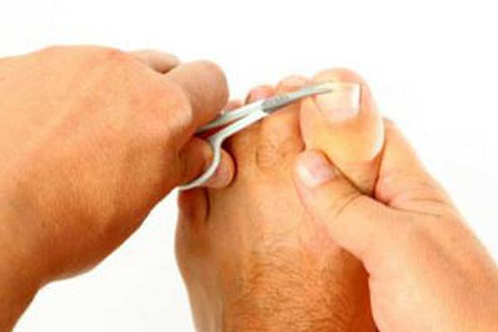 Как подстригать ногти на большом пальце. Правильная стрижка ногтей на ногах. Подстригание ногтей на ногах. Правильно подстриженные ногти на ногах.