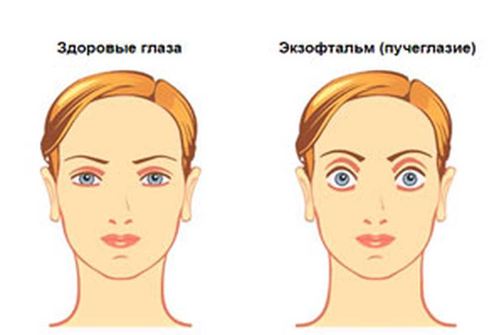 Щитовидная Железа Фото У Женщин Лечение