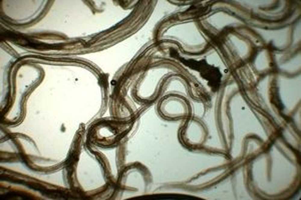 Болезни гельминтозы. Ленточные черви гельминты. Цестоды (лентецы, ленточные черви).