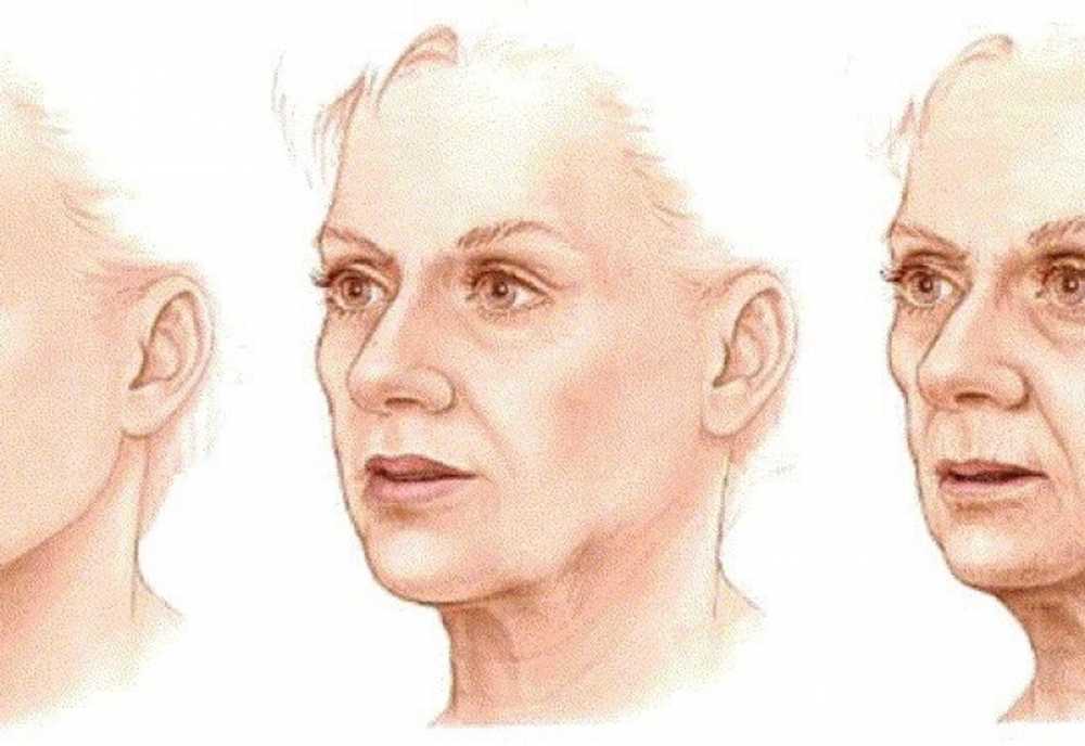 К старости вообще половые и. Возрастные изменения кожи лица. Возрастные изменения овала лица. Возраст к лицу. Возрастные изменения лица у женщин.