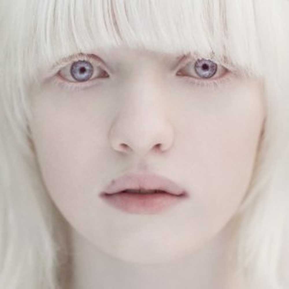 Включи белыми глазами. Настя Жидкова альбинос. Настя Жидкова модель. Настя Кумарова.