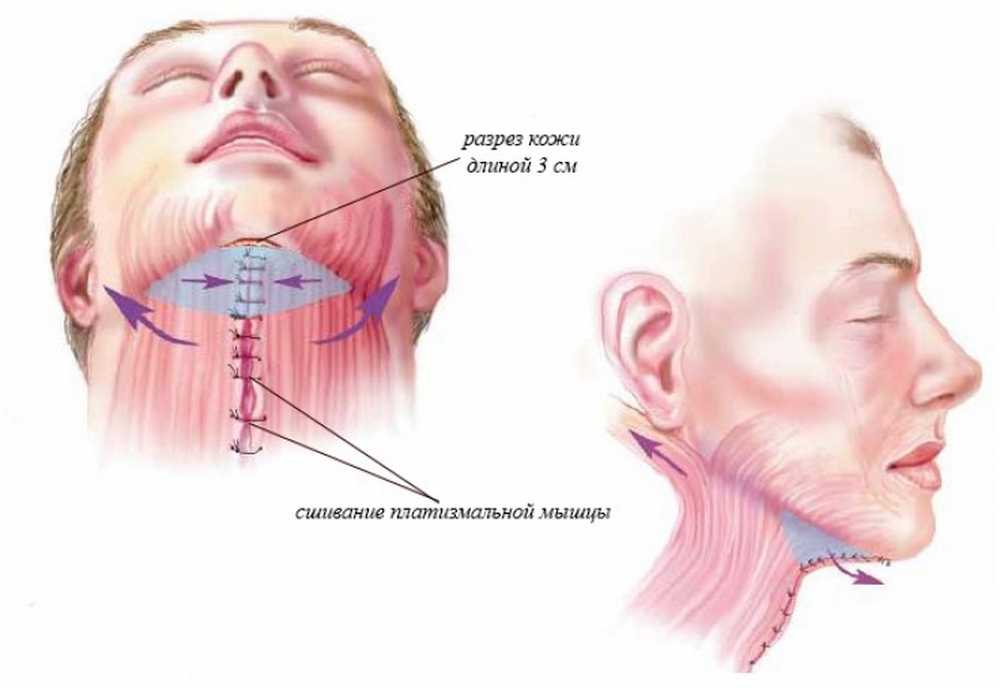Где заканчивается лицо. Части лица в косметологии. Нижняя часть подбородка. Названия частей лица в косметологии. Скула на лице это где.
