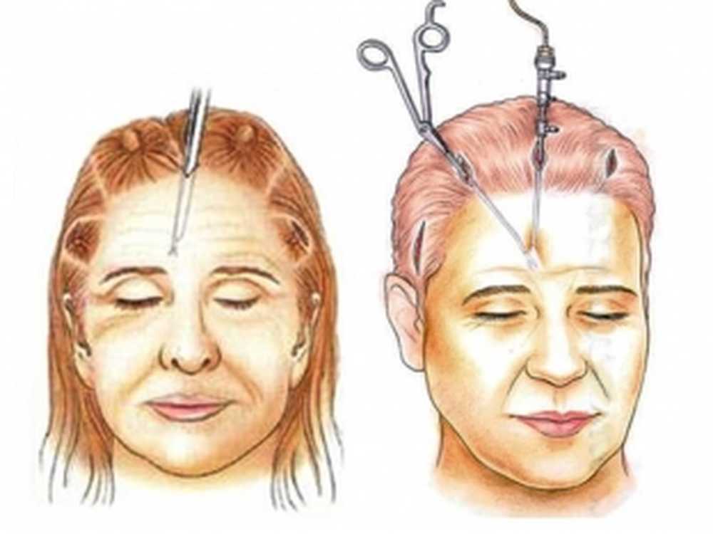 пластическая хирургия. пластичсекаяо перация. методы пластической операции. принципы пластической хирургии. пластическая хирургия презентация.