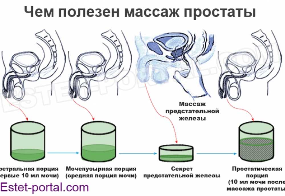 How to perform a prostate massage