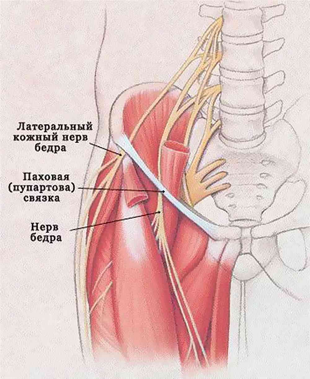 Невропатия бедра нерва