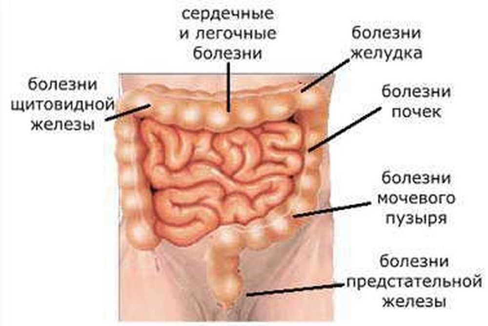 Кишечник очищается перед. Пневматоз тонкого кишечника.