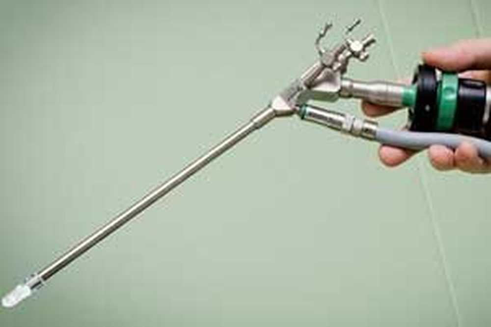 Эндоскопия грыжи позвоночника. Эндоскопическая грыжа фораминальная. Эндоскопическая операция грыжи. Эндоскопическая операция на позвоночнике. Лазерная вапоризация грыжи позвоночника.