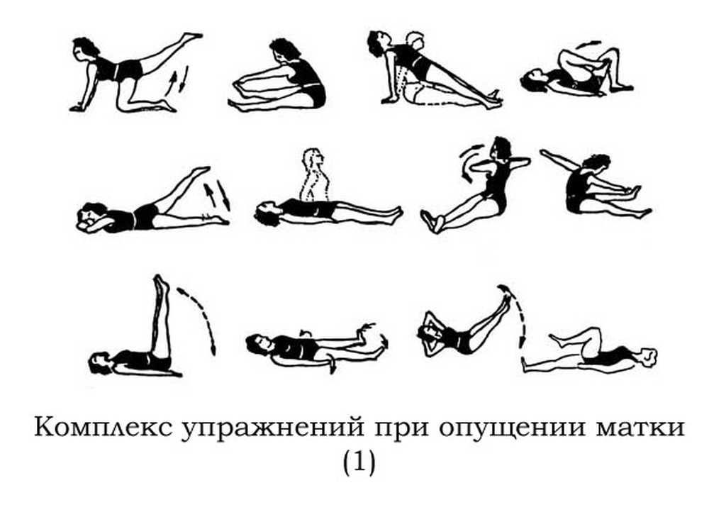 Кегель упражнения для женщин после родов. Опущение стенок матки упражнения. Гимнастика кегеля для женщин при опущении матки. Опущение матки лечебная гимнастика. Упражнение кегеля для женщин для укрепления мышц матки при опущении.