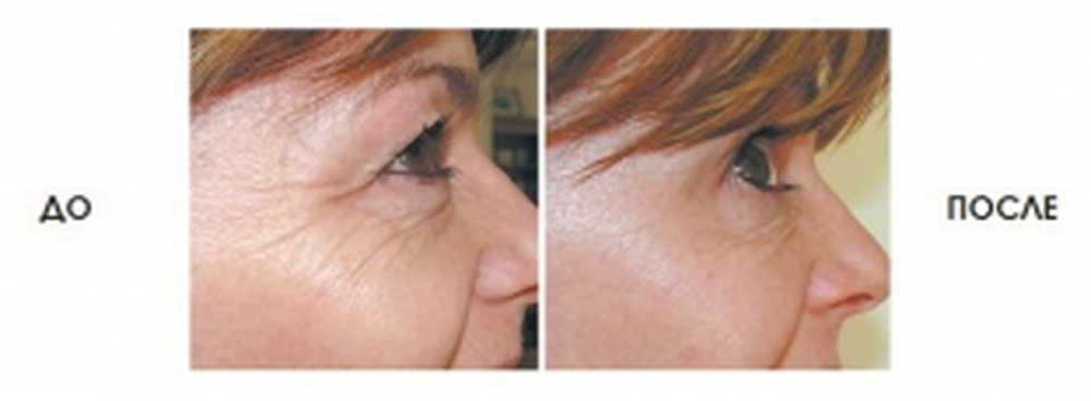 Фотографии ПОСЛЕ АР