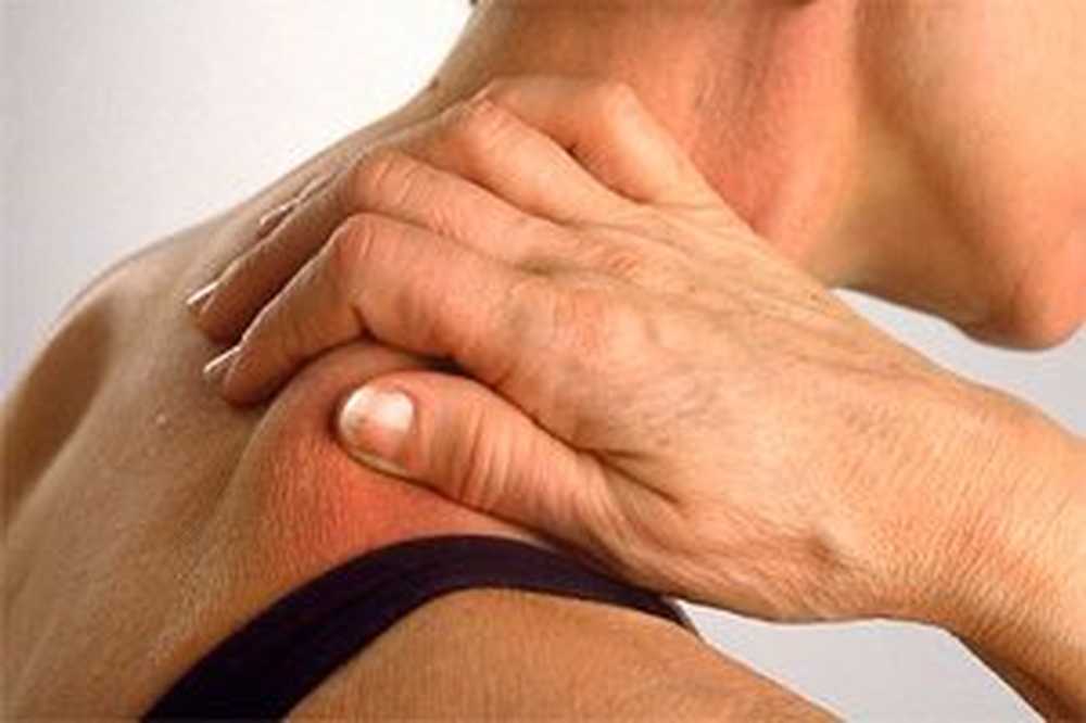 Упражнения при шейном миозите. Воспаление мышц миозит. Воспаление скелетных мышц – миозит;. Симптомы болезни мышц спины. Миозит у взрослых.