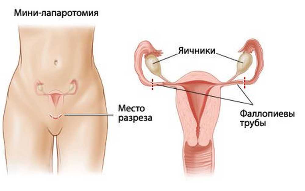Где матка и яичники. Где находятся яичники и маточные трубы. Расположение маточных труб и яичников. Расположение матки и маточных труб. Яичники маточная труба расположение у женщин.