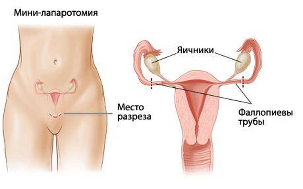 Фото матки и яичников у женщин картинки
