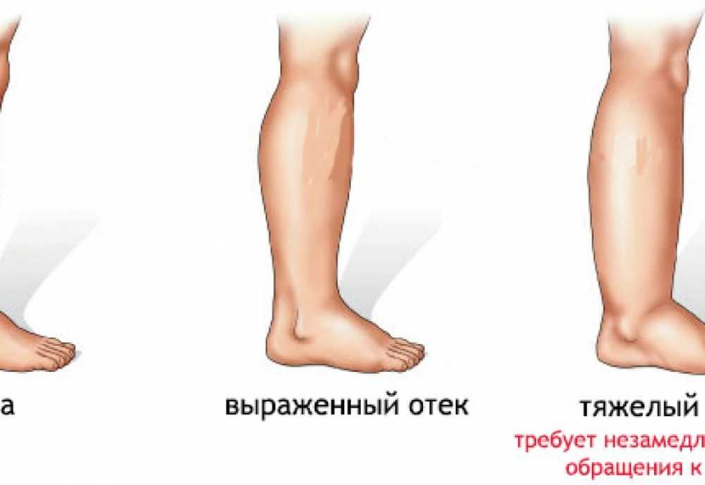 Опухоль Причины Фото