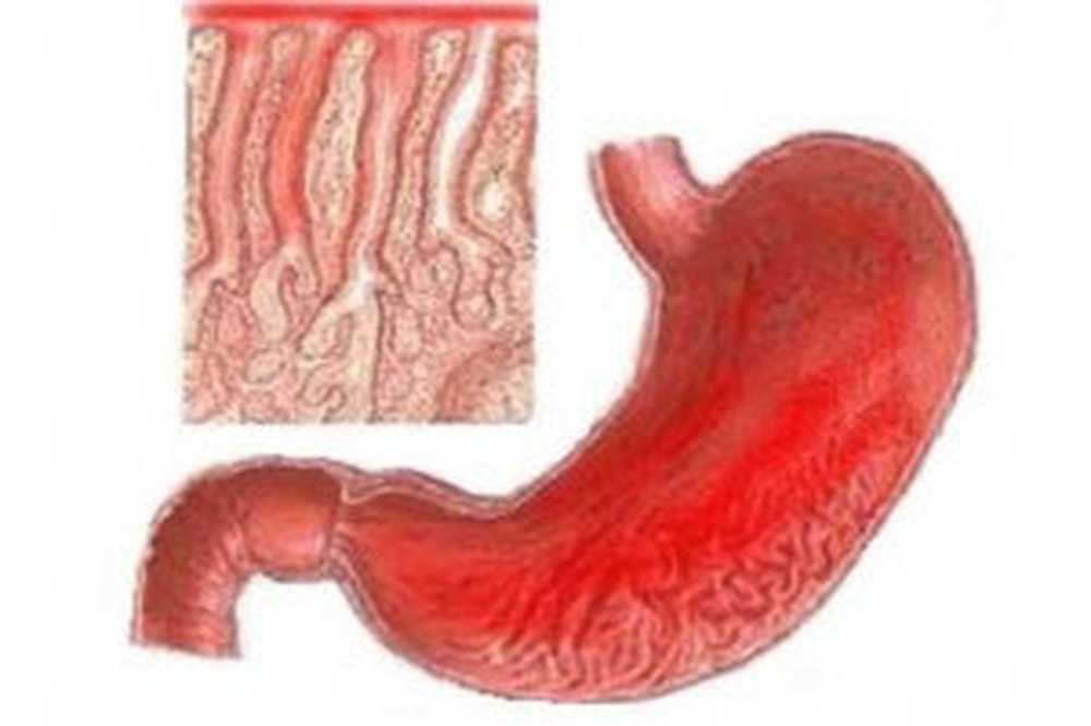 Gastritis nerviosa foro