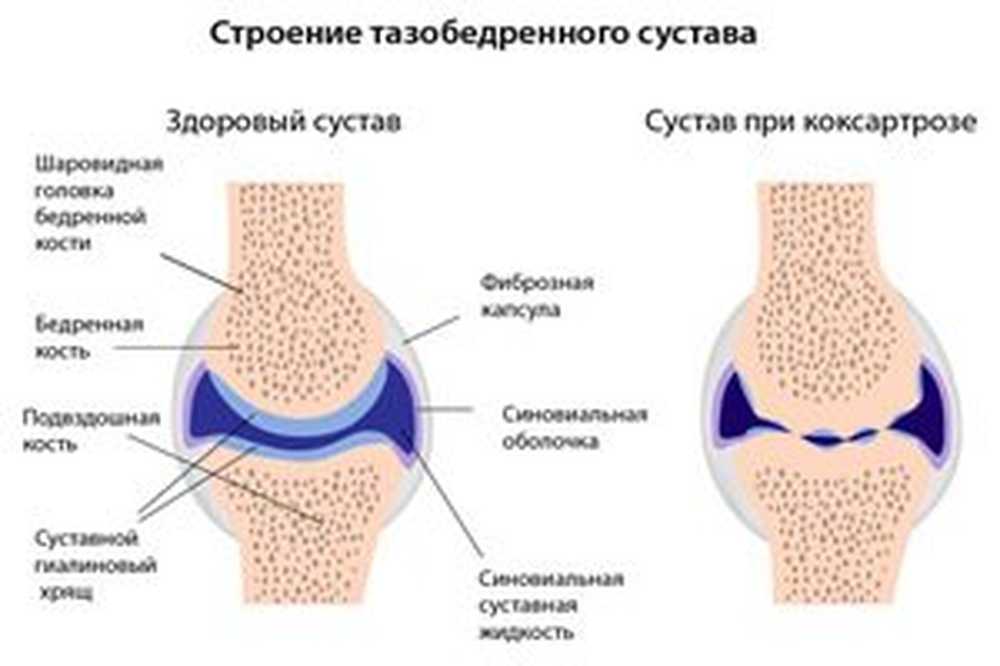 3 признака сустава