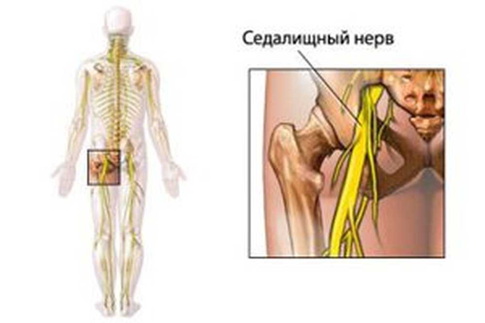 Седалищный нерв картинка где находится