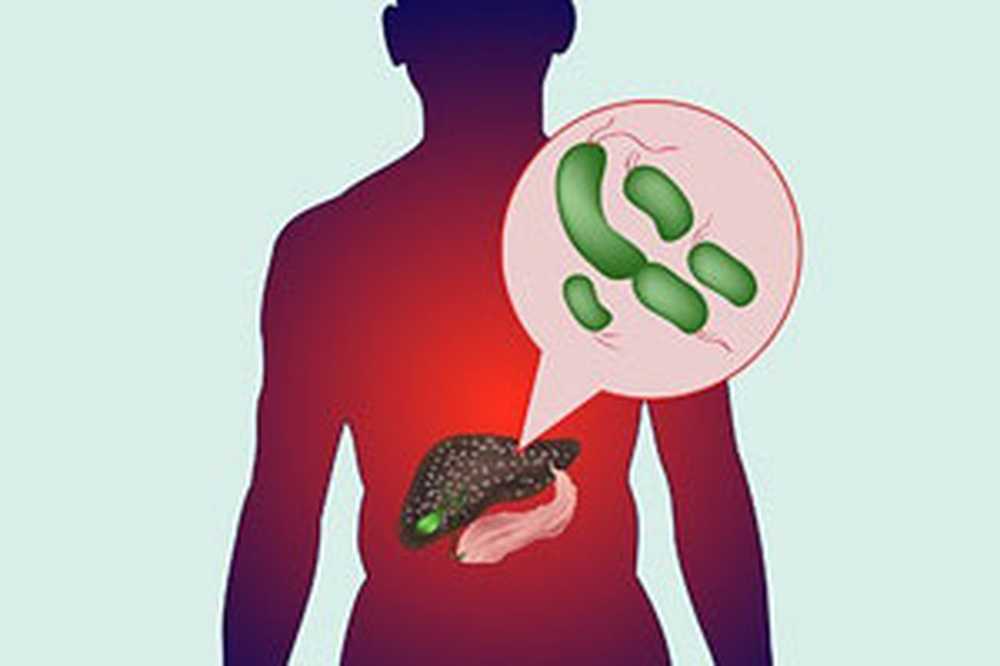 лептоспиры микроскопия. болезни связанные с нарушением выработки ферментов. лептоспира темнопольная микроскопия. бактерии живущие в печени человека. Francisella tularensis морфология.