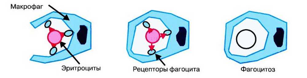 Реакция иммунного гемолиза. Механизмы внутрисосудистого гемолиза эритроцитов. Внесосудистый гемолиз. Внесосудистый гемолиз схема. Внутриклеточный гемолиз схема.