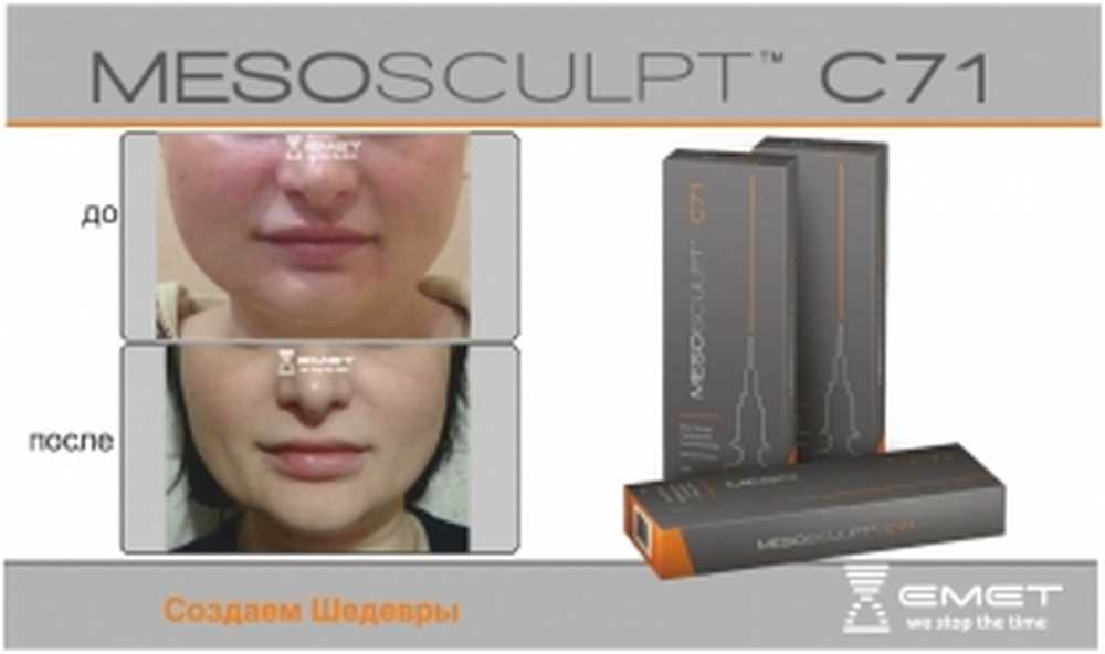 Мезоскульпт с 71. MESOSCULPT для лица. Мезоскульпт для овала лица. Мезоскульпт биоревитализация.