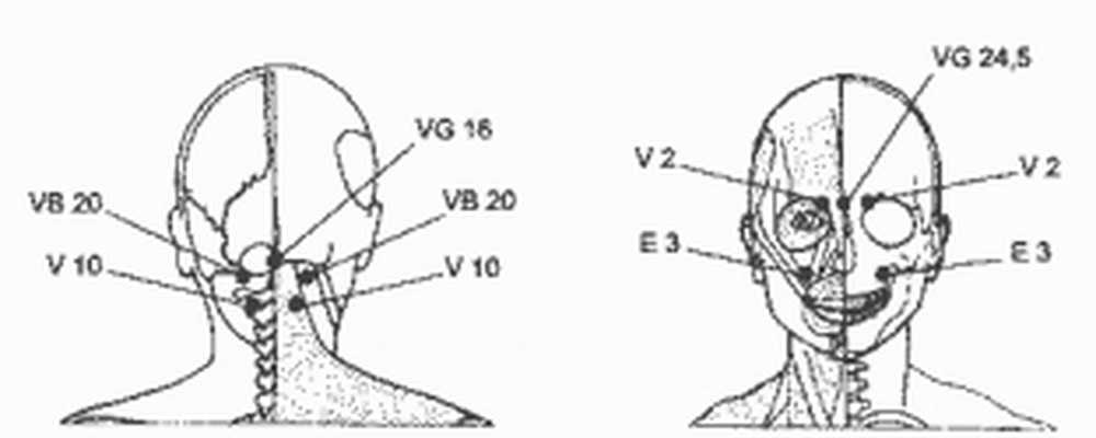 Какую точку массировать при головной. Точки при головной боли мигрень. Точечный массаж при головной боли и мигрени точки. Акупунктурная точка от мигрени. Акупунктурные точки при мигрени.
