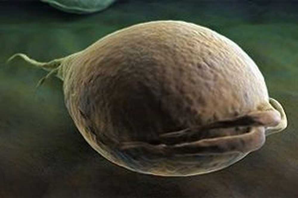 Трихомонада урогенитальная рисунок. Трихомонада урогенитальная цикл развития. Трихомонада у беременных. Трихомонада у беременных. Трихомонада у беременных.