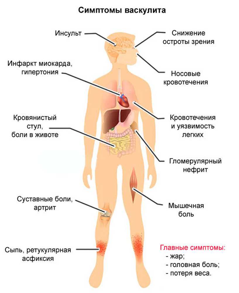 Высыпания На Ногах Картинки
