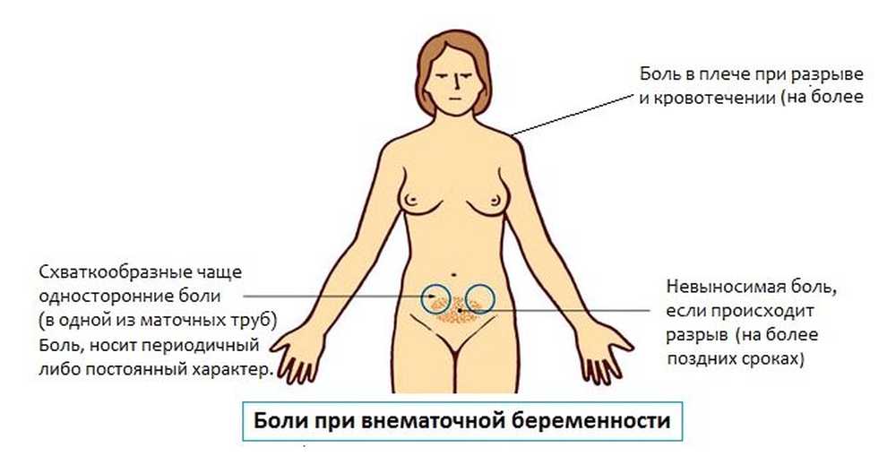 После Секса Стал Болеть Низ Живота