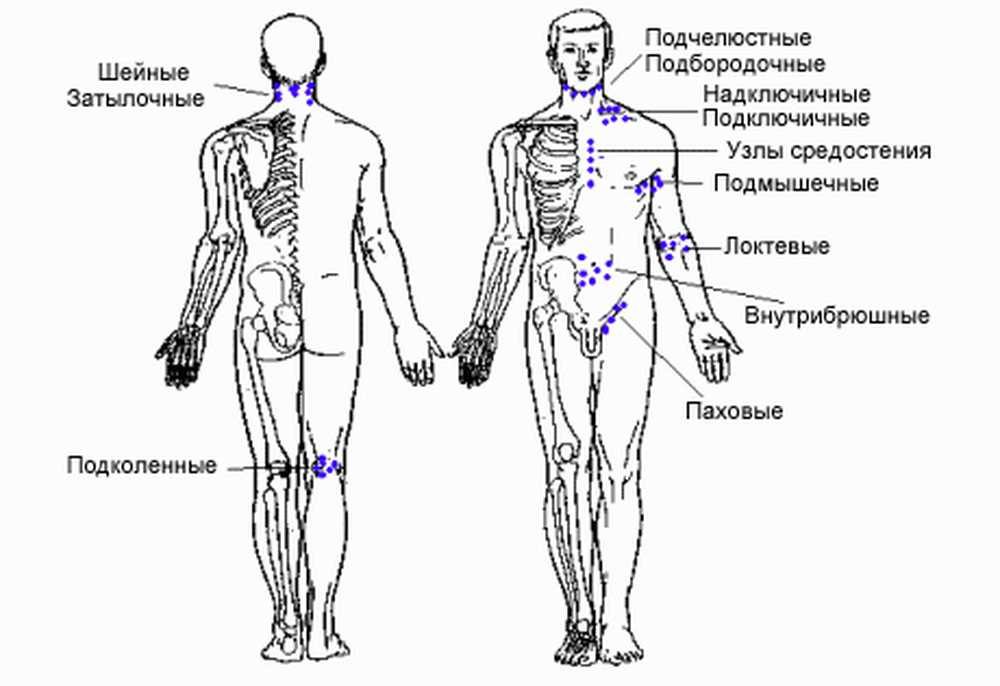 Лимфоузел справа у мужчины. Схема расположения лимфоузлов на теле человека. Где у человека находятся лимфоузлы схема. Лимфоузлы где находятся у мужчин. Лимфатические узлы на спине расположение.