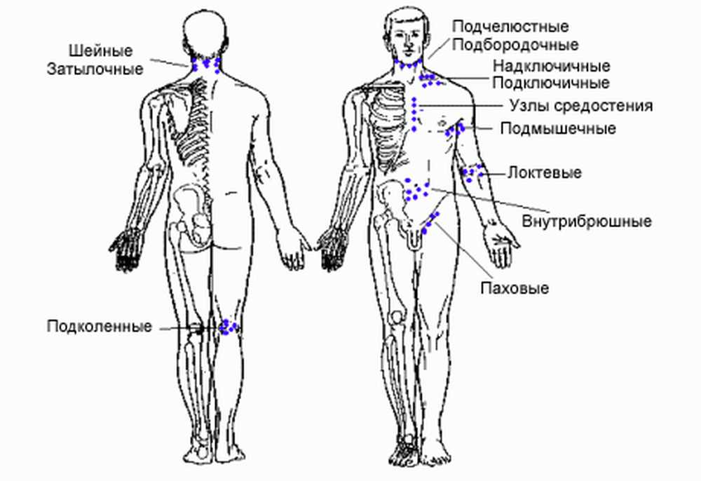 Паховый лимфоузел у женщин где. Схема расположения лимфоузлов на теле человека. Где у человека находятся лимфоузлы схема. Лимфоузлы где находятся у мужчин. Лимфатические узлы на спине расположение.