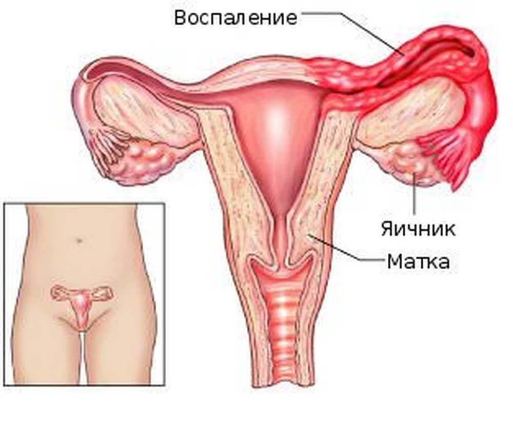 Что Такое Матка Женщины Фото