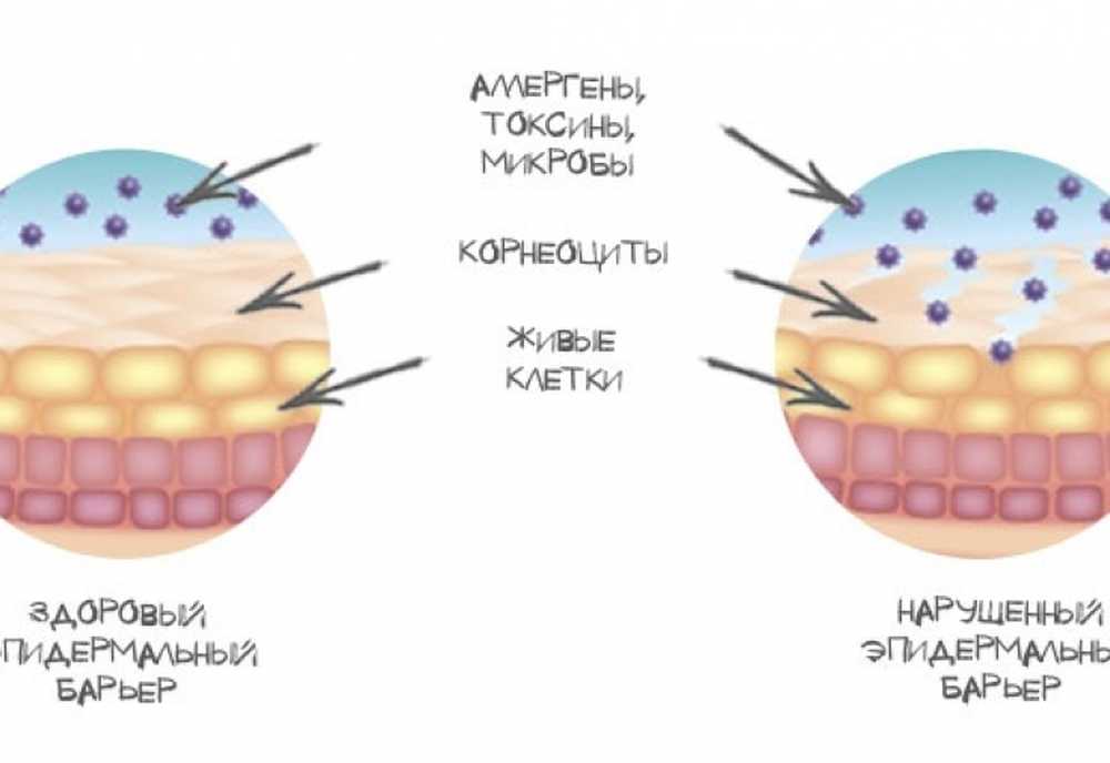Состав эпидермального барьера кожи. Строение эпидермального барьера. Какая клетка формирует защитный барьер кожи. Состав эпидермального липидного барьера кожи. Какая клетка формирует защитный барьер кожи.