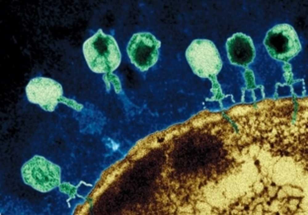 Вирус поражающий бактерии. Бактериофаги Myoviridae. Бактериофаги- Пожиратели бактерий. Бактериофаг микроскопия. Бактериофаг стафилококковый микроскоп.