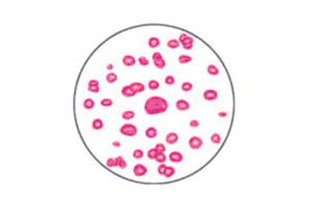 Анизоцитоз. Анизоцитоз полихромазия. Показатель анизоцитоза эритроцитов у кошки. Размер эритроцита в норме. Rdw анизоцитоз.