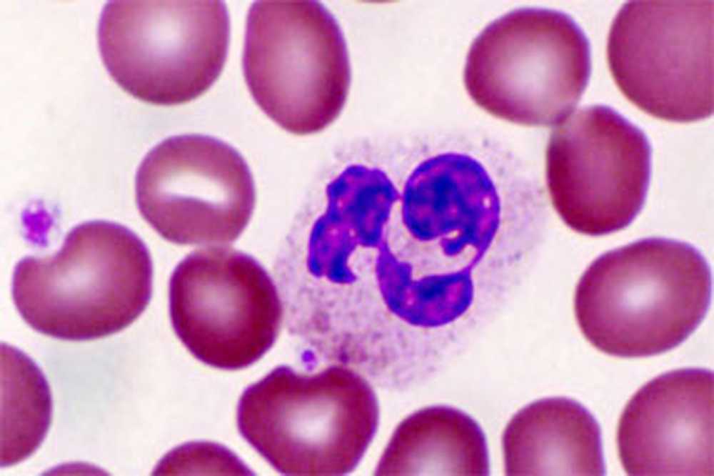 Базофилы в крови 1. Базофилия ядер клеток. Базофилы (Baso). Базофилы фото. Базофил под микроскопом.