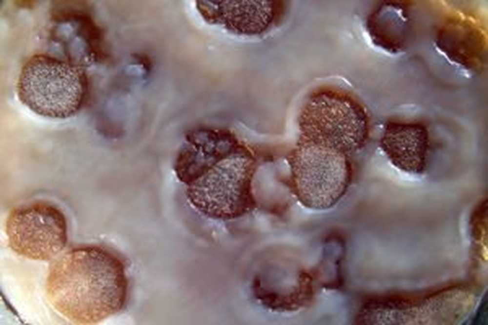 Заболел грибом. Чайный гриб микроскоп. Чайный гриб под микроскопом. Заболевание чайного гриба.