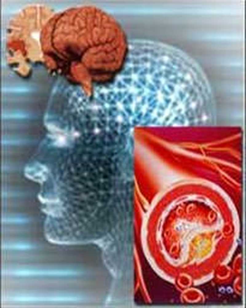 Дисциркуляторная энцефалопатия с вестибулопатией. Дисциркуляторная энцефалопатия с вестибулопатией. Дисциркуляторная энцефалопатия с вестибулопатией. Дифференциальный диагноз дисциркуляторной энцефалопатии. Дисциркуляторная энцефалопатия на кт.