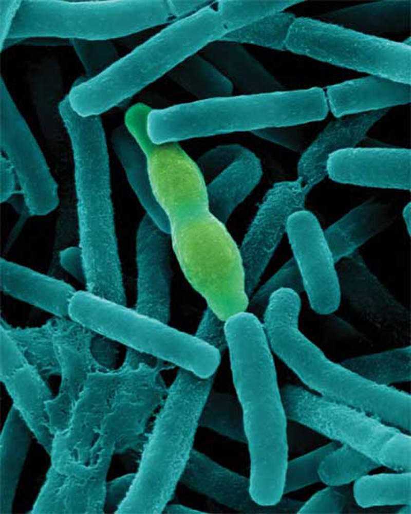 Бактерия вызывающая язву. Бацилла антрацис Сибирская язва. Bacillus anthracis, а22 (Сибирская язва). Бацилла сибирской язвы Bacillus anthracis. Bacillus anthracis под микроскопом.