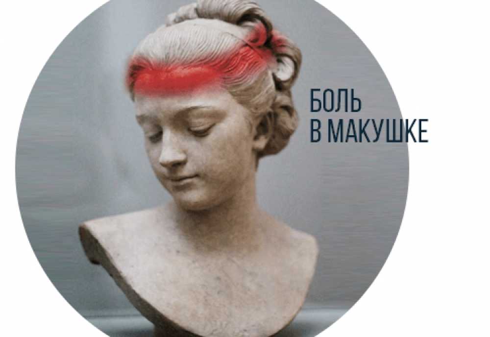 Головная боль напряжения локализация. Головная боль при стрессе. Головная боль локализация. Болит голова обручем. Различие головной боли.