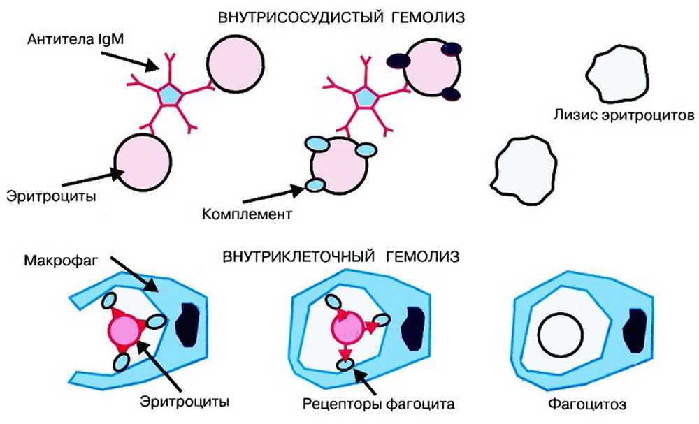 Иммунный гемолиз