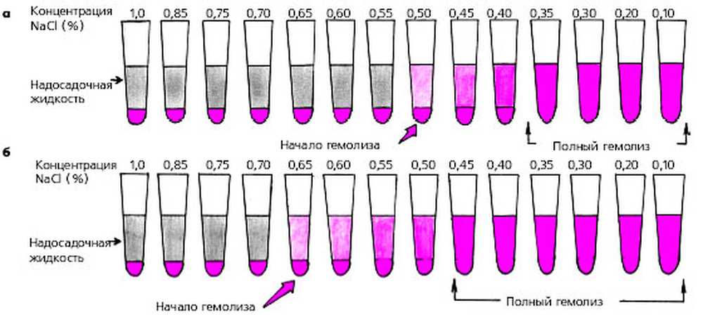 норма осмотической стойкости эритроцитов. осмотическая стойкость эритроцитов физиология. понятие об осмотической резистентности эритроцитов. методика исследования осмотической стойкости эритроцитов. норма осмотической стойкости эритроцитов.
