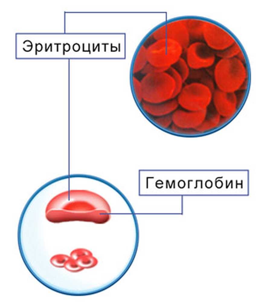 Анемия и эритроциты в крови