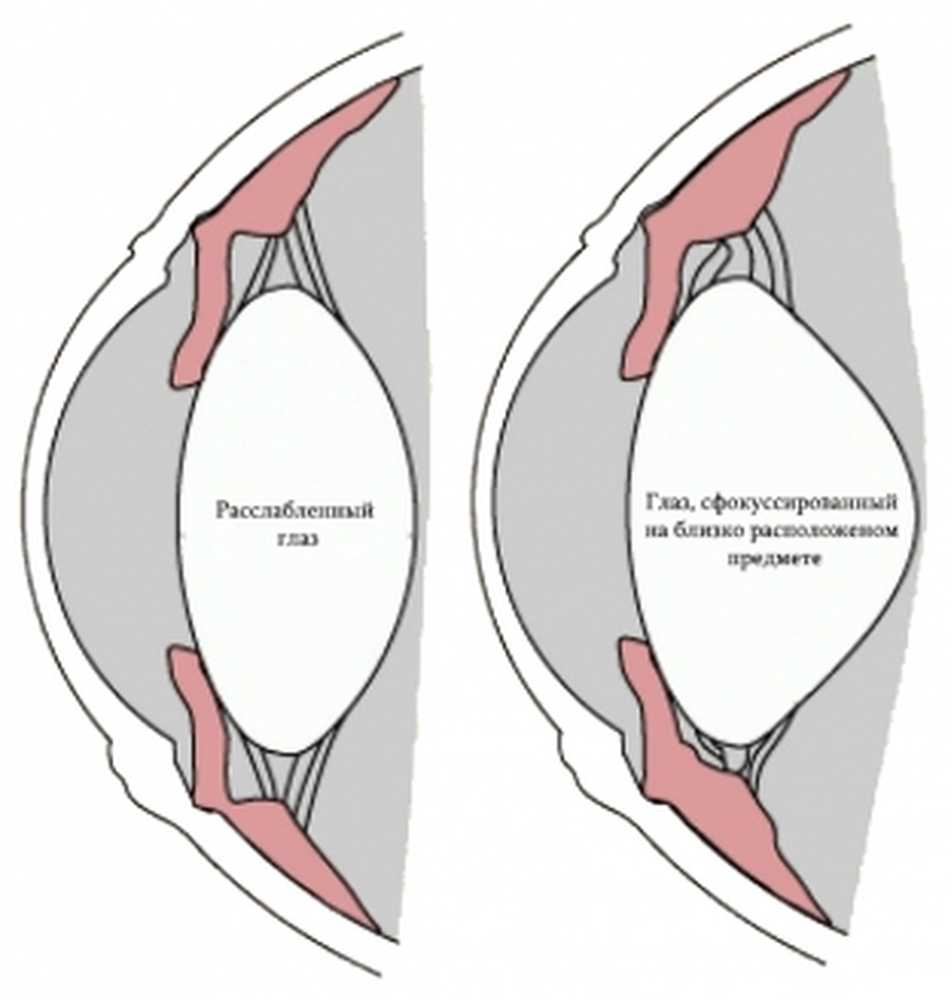 Расслабленное зрение. Спазм аккомодации глаз. Аккомодация спазм аккомодации. Спазм аккомодации мышцы. Цилиарная мышца глаза спазм аккомодации.