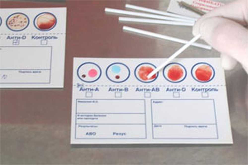 Определить группу крови тест. ЭРИТРОТЕСТ ГРУППОКАРТ. Планшет для определения группы крови и резус фактора. Тест полоски на определение группы крови. Набор ЭРИТРОТЕСТ-ГРУППОКАРТ.
