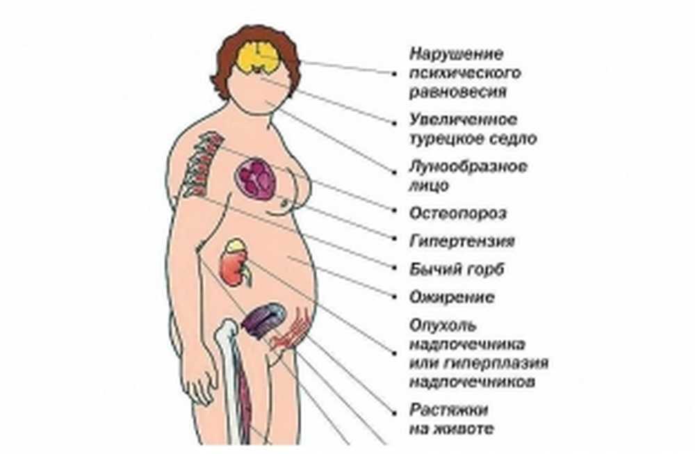 Надпочечники симптомы у женщин после 50