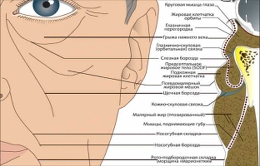 Линии ниже глаз. Носослезная борозда схема. Строение малярного мешка. Малярный мешок слезная борозда. Малярный мешок слезная борозда коррекция.