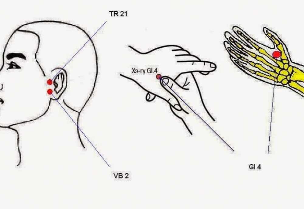 Какие точки массировать на руке. Активные точки для снятия головной боли. Точка для снятия глазной боли. Точки для снятия головной боли при мигрени. Точки акупунктуры для снятия головной боли.