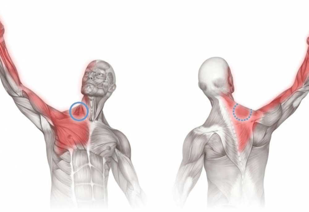 Болит плечо отдает в голову. Лестничные мышцы триггерные точки. Триггерные точки в лестничных мышцах шеи. Синдром лестничной мышцы триггерные точки. Мышцы поднимающие руку.