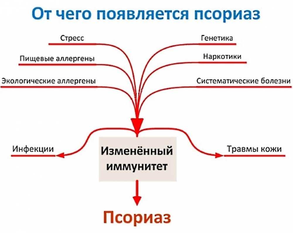 Псориаз Фото Лечение У Взрослых