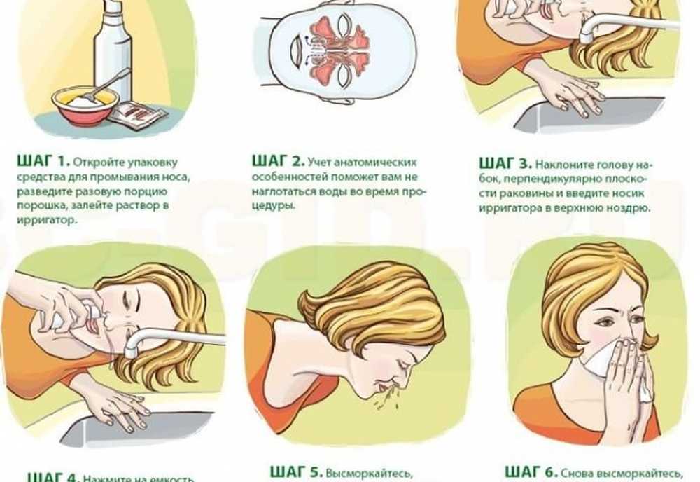 Промывание носа не вытекает из другой. Промывание носа. Схема промывания носа. Как правильно промывать нос. Для промывания носа для детей.