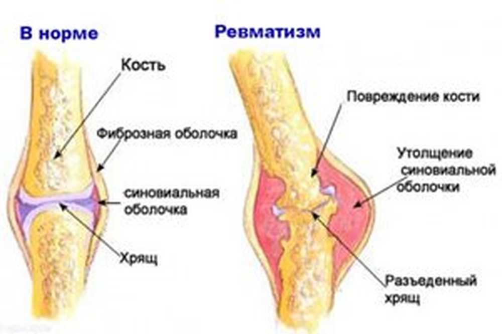 3 признака сустава